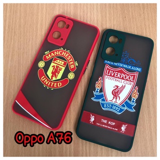 OPPO A76 5G เคสกันกล้องลายการืตูน งานขอบสีหลังด้าน สินค้าพร้อมส่ง