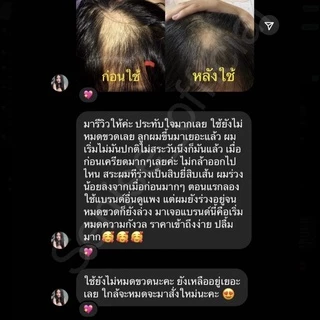 senise shampoo แชมพูเซนิเซ่ แชมพูของน้ำปาย ลดผมร่วง หัวมันง่าย เป็นสิว เร่งผมยาวไว เร่งผมงอกใหม่ เหมาะกับผิวแพ้ง่าย