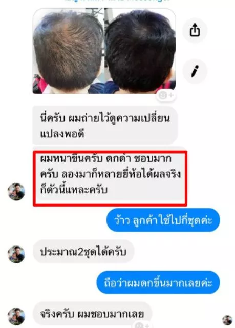แชมพูสมุนไพร Chaya herb อัญชันลดผมร่วงเร่งผมยาว 360ml thumbnail 5