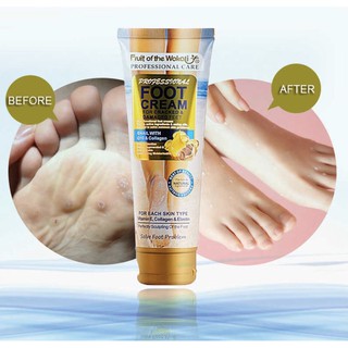 ครีมทาเท้าแตก Fruit of the Wokali Foot Cream แก้ส้นเท้าแห้งแข็งกระด้าง ครีมทาเท้าขาว ครีมทาส้นเท้าแตก ครีมทาส้นเท้า