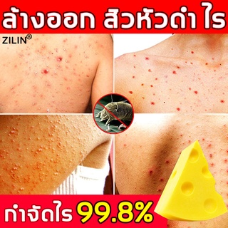 สบู่ สบู่ชีส 100g สบู่ต้านแบคทีเรีย สบู่ผิวขาว สบู่น้ำผึ้งทอง โฟมล้างหน้าสิว สบู่ลดสิวหน้า สบู่ลดรอยสิว