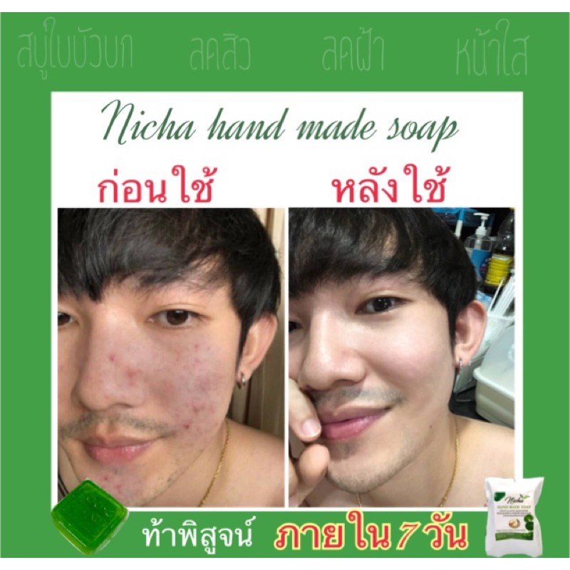 เซ็ท  Centella asiatica