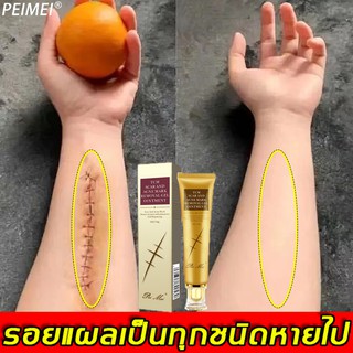 【มีสินค้าพร้อมจัดส่ง】Peimei 30g ครีมลดรอยแผลเป็น แผลเป็น รอยแดง เจลลบรอยแผลเป็น แผลผ่าตัดแผลไฟไหม้  ครีมรักษาแผลเป็น