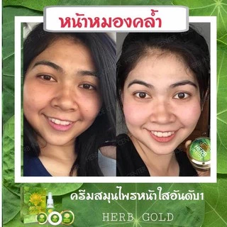 HERB Gold ครีมเฮิร์บ โกลด์ ชุด ครีม 30กรัม+ สบู่ 50 กรัม