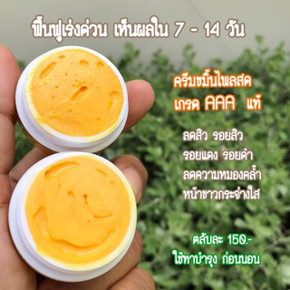 [สิว] ครีมขมิ้น ไพลสด ลดสิว ครีมขมิ้นต้นตำรับ ครีมขมิ้นไพลสด