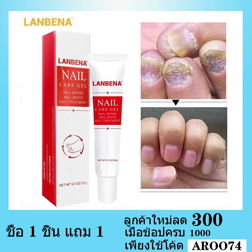 LANBENA เจลรักษาเล็บ ลบเชื้อราเล็บ บำรุงผิว รักษาอาการปวด ใช้ได้มือและเท้าNail Care Gel Fungal Nail 