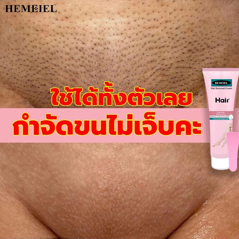 HEMEIEL PARIN IPL LASER กำจัดขนถาวร/ครีมกำจัดขนแร้/แวะกำจัดขน/ครีมกำจัดขนขา