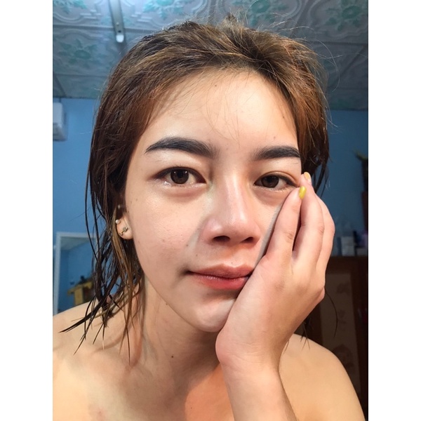 ขมิ้นรักษาสิว Princess