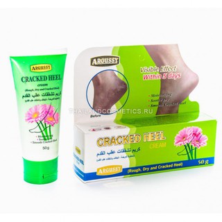 Yoko Cracked Heel Cream Argussy  50g. โยโกะ ครีบำรุงผิวส้นเท้าแตก สูตรปรับปรุงใหม่(สีเขียว) 50กรัม