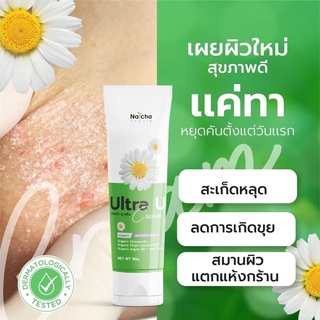2แถม1 "บอกลาสะเก็ดเงิน" Ultra U อัลตร้ายู ครีมทาเชื้อราที่ผิวหนัง ผิวแห้งคัน ส้นเท้าแตก ด้วยสารสกัดจากธรรมชชาติ100%