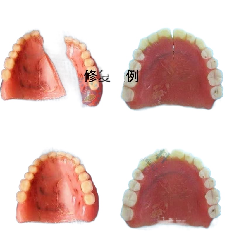 ☋▩☌กาวติดฟันปลอม ฟันปลอมหลุด ฟันปลอมหัก ฟันปลอม กาวติดฟันปลอม กาวติดแน่น