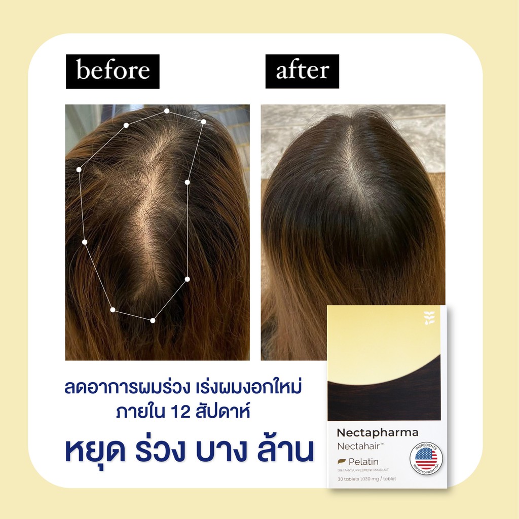 สั่งซื้อสินค้าจาก Nectapharma ออนไลน์ | Shopee Mall Thailand