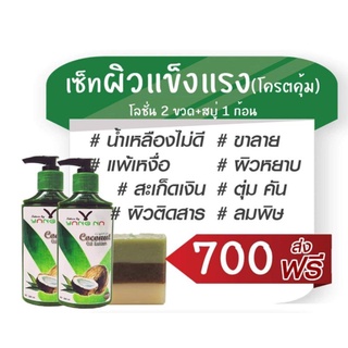 🔥ส่งฟรี🔥ยา งนา  โลชั่นน้ำมันมะพร้าว กับ สบู่น้ำมันธรรมชาติ แก้ขาลาย จุดด่างดำ ผิวอักเสษ สิวหลัง ผื่นคันรื้อรัง ปัญหาผิว