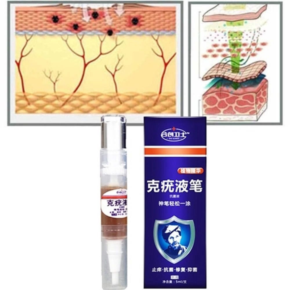 Body Warts Treatment Cream Skin Tag Remover Foot Corn Removal Plantar Genital Warts Ointment Footครี