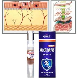 Body Warts Treatment Cream Skin Tag Remover Foot Corn Removal Plantar Genital Warts Ointment Footครีมกำจัดหูดที่ผิวหนัง