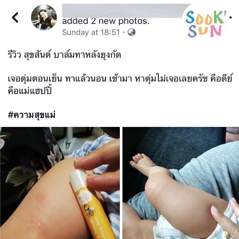 บาล์มผึ้งน้อยสุขสันต์ ทาหลังยุงหรือแมลงกัด ลดผดผื่นคัน บำรุงผิว ออร์แกนิค (สูตรoriginal) ลดคัน ลดบวมได้เร็ว ขนาด 5 ml