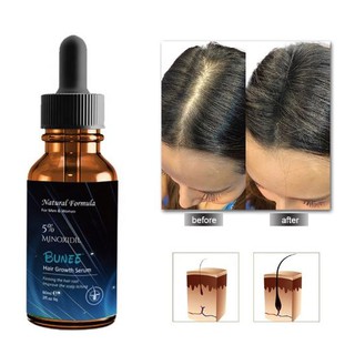 Bunee hair growth Serum เซรั่มบำรุงหนังศรีษะปลูกเส้นผมใหม่