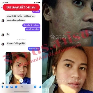 DR.SAROJ(ของแท้) ดร.สาโรช (Dr.Saroj) โลชั่นรักษาสิว สำหรับสิวอุดตัน (ทาทั่วหน้า) 60 ml.