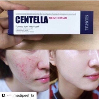 Medi-peel Centella Mezzo Cream 30ml  ไอเทมกู้หน้าดีดี