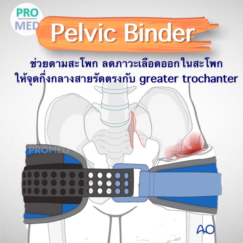 Pelvic Binder SAM pelvic sling Pelvic binding pelvic wrapping สายรัด ...