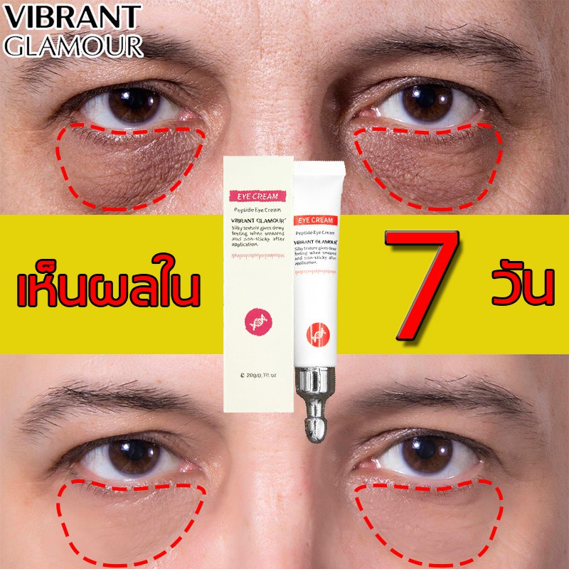 ครีมลดใต้ตาดำถุงใต้ตา 20Ml. อายครีม อายครีมบำรุงรอบดวงตาสามารถลดถุงใต้ตา  ขอบตาดำ แบ่งเบาริ้วรอย ลดใต้ตาดำ ครีมลดใต้ตาดํา | Shopee Thailand