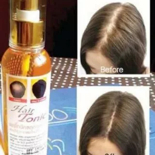 🔥ค่าส่งถูก+แท้🐌 Genive Hair Tonic 120ml มีอย. ลดผมร่วง ปลูกผม ขจัดรังแค แก้คัน จีนิวี แฮร์ โทนิค Spray บำรุงรากผม