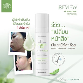 AcnoClear Facial Cleanser 100ml                               เจลล้างหน้าลดสิว