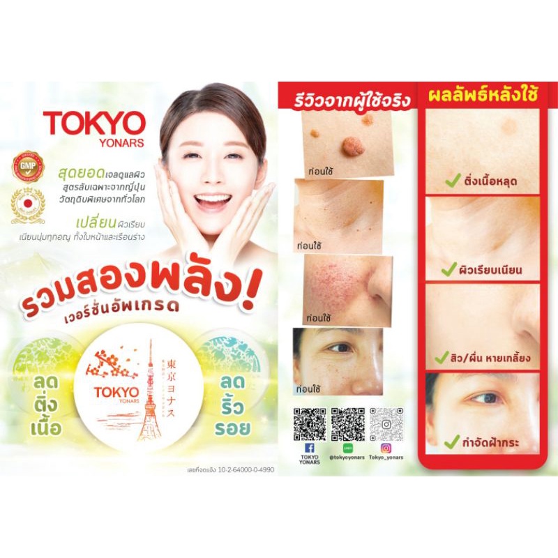 Tokyo Yonars โตเกียว โยนาร์ส เจลลดติ่งเนื้อ ฝ้า กระ สิวหิน สิวอุดตัน ผดผื่น ผลลัพธ์ 100% (ชื่อเดิม W