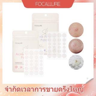 Focallure แผ่นแปะสิว ควบคุมความมัน กันน้ำ