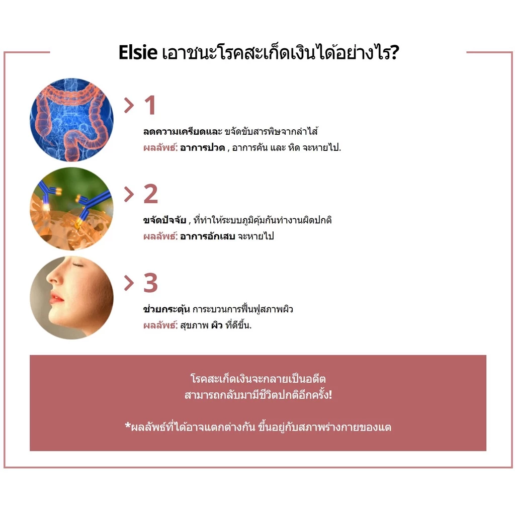 ELSIE ผลิตภัณฑ์ฟื้นฟูสุขภาพผิวหนัง และบรรเทาสะเก็ดเงิน - เซ็ต 3 กล่อง thumbnail 9