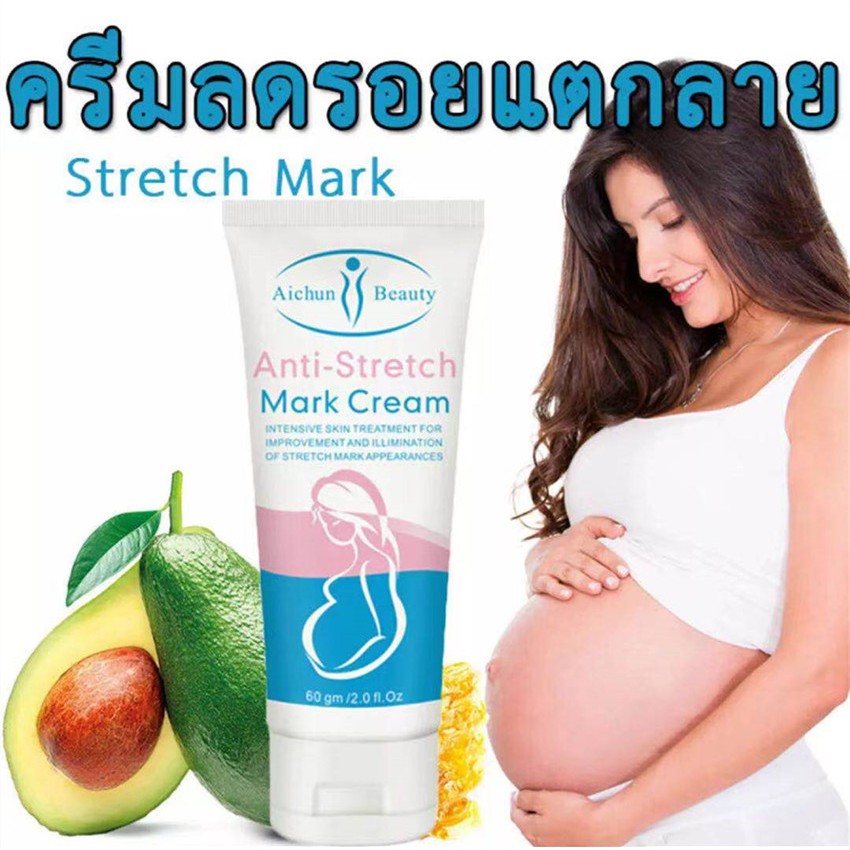 AICHUNครีมกันแตกลายครีมทาท้องลาย60กรัม