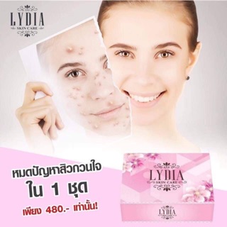 ครีมลิเดีย 🌸 Lydia Cream ครีมรักษา สิว ฝ้า กระ - ลดการสร้างเม็ดสี ทำให้ฝ้า กระ จางลง