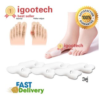 igootech ซิลิโคนคั่นนิ้วเท้า นิ้วโป้ง/นิ้วชี้ (สำหรับผู้มีนิ้วโป้งเท้าเอียง) (x3คู่)