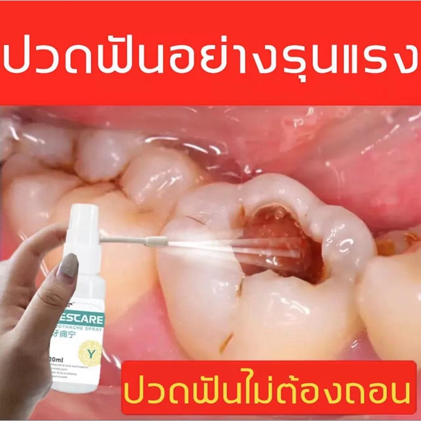 [จัดส่งทันที]จัดส่งที่รวดเร็ว ยาพ่นแก้ปวดฟัน BESCARE สารสกัดสมุนไพรจีน พบหมอฟันสิบครั้ง ฉีดครั้งเดียวดีกว่า สูตรธรรมชาติ