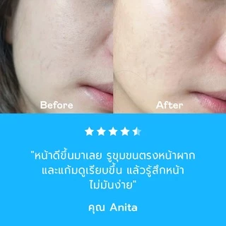 DIVYNE Pure Serum Niacinamide + Zinc 30ml เซรั่มสิว กระชับรูขุมขน หน้ามัน