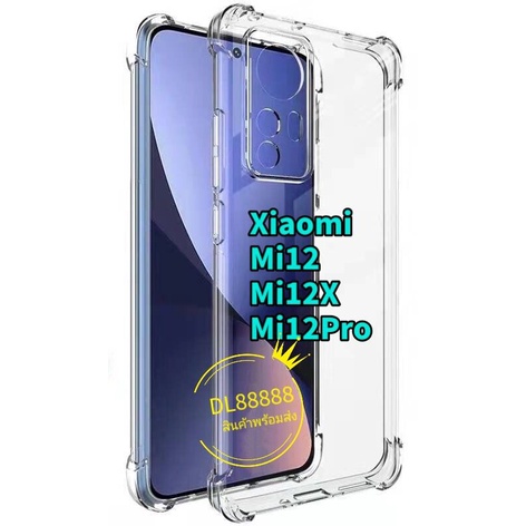 Mi 12 ✨พร้​อมส่งใน🇹🇭✨เคสใสกันกระแทกคลุมกล้อง For Xiaomi 12 / Mi12 / Mi 12X / Mi12X / Mi12 Pro / Mi 1