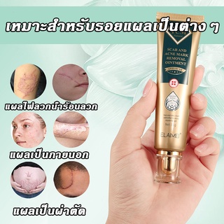 ครีมทารอยแผลเป็น 30g กำจัดรอยแตกลาย แผลไฟไหม้ น้ำร้อนลวก ครีมทารอยสิว แผลผ่าตัด ทาแผลเป็นนูน ครีมลบแผลเป็น ครีมทาแผลเป็น