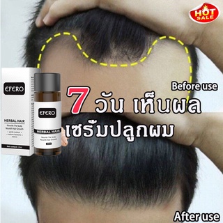 พร้อมส่ง✈เซรั่มปลูกผม น้ำยาปลูกผม30ml ช่วยปรับปรุงผมร่วง เร่งการเจริญเติบโตของเส้นผม ยาปลูกผมของแท้ เซรั่มบำรุงผม ปลูกผม สำหรับผมบาง นีโอแฮร์ของแท้ สเปรย์ปลูกผม น้ำยาปลูกผมชาย ปลูกผมเร่งด่วน น้ำยาเร่งผมยาว น้ำยาใส่ผม