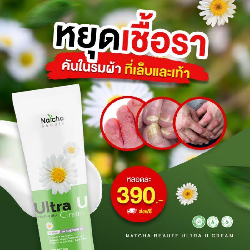 #ครีมอัลตร้ายู #Natcha #ครีมทายูเรีย #ยูเรีย9% #รักษาผิวหนังอักเสบ