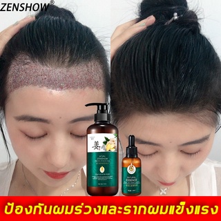 ZENSHOW แชมพูขิง ควบคุมความมันและป้องกันผมร่วง  （แชมพูป้องกันผมร่วง น้ำยาบำรุงเส้นผม  ）Ginger shampoo