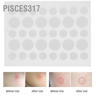 Pisces317 แผ่นสติกเกอร์ไฮโดรคอลลอยด์ แบบใส สําหรับติดปกปิดสิว 36 ชิ้น ต่อแผ่น