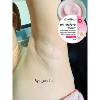 ครีมทารักแร้ขาวโออัจชา 30g