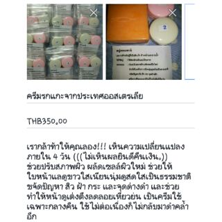 ครีมรกแกะจากออสเตร ลดฝ้า​ กะ​ สิว​ หน้าใสเลิกใ0