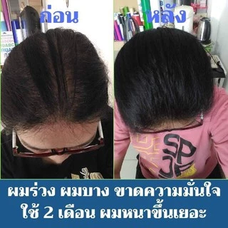 ❗คุ้ม (แพ็ค2)​ สเปรย์ เร่งผมยาว​ ปลูกผม แก้ผมร่วง แก้ผมบาง ขจัดรังแค บำรุงรากผมใหม่ให้แข็งแรง 120มล.