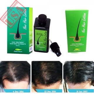 Neo hair Lotion สินค้าที่แท้จริง นีโอ แฮร์ โลชั่น (120 ml)