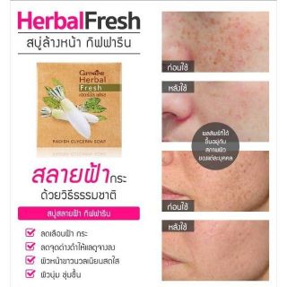 🔥ส่งฟรี🔥สบู่หัวไชเท้า รักษาฝ้า กิฟฟารีน