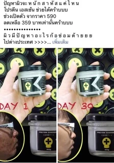 โปรตีนบัวหิมะ แก้ผดผื่น แก้รอยแตกลาย ใช้ได้ตั้งแต่เด็ก3ขวบ