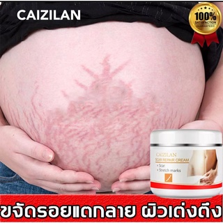 ครีมลดรอยแตกลาย CAIZILAN ครีมลดรอยแตกลาย 30ml แก้ปัญหารอยแตกลาย คืนความยืดหยุ่นและความเงางาม ครีมทาท้องลาย