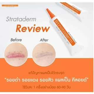 Strataderm gel / Stratamed สตาร์ตาเมด เจล ทา รักษา แผลสด แผลเป็น แผลนูน หลุมสิว ตา2ชั้น ขนาด 5/ 10 g