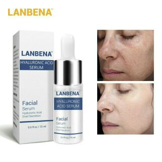 เซรั่มบำรุงผิว LANBENA Hyaluronic Acid Serum Treat Skin Whitening Essenceพิเศษ สำหรับ ลูกใหม่ อย่าลืม กรอกโค้ดส่วยลด